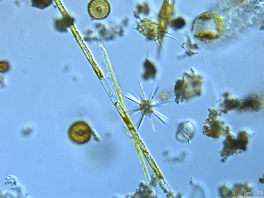 Plankton are a vital food source for many organisms and their activity in the ocean helps regulate the absorption of carbon from the atmosphere to the ocean. Photo Credit: Marine Biological Association.