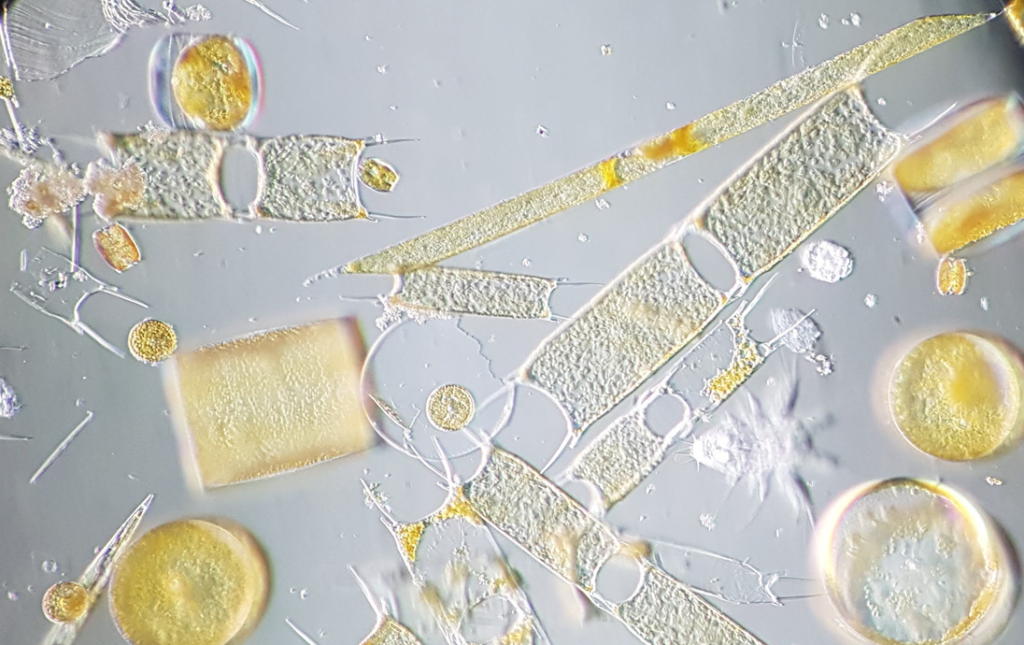 Phytoplankton cells under a microscope