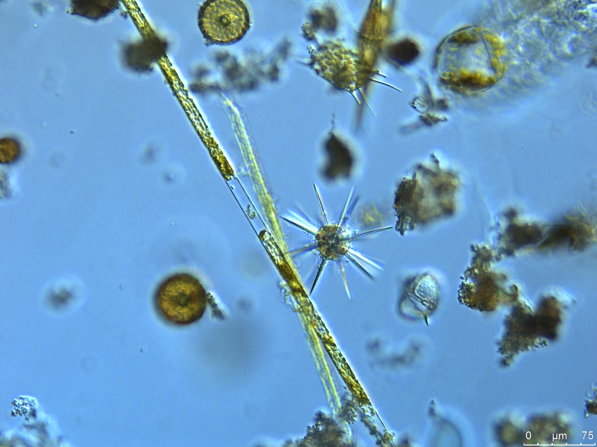 examining the influence of nutrient colimitation on phytoplankton ecophysiology Katherine Helliwell microscope